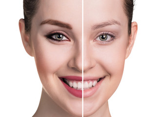 Top 10 Healthy Ways To Grow Your Eyelashes