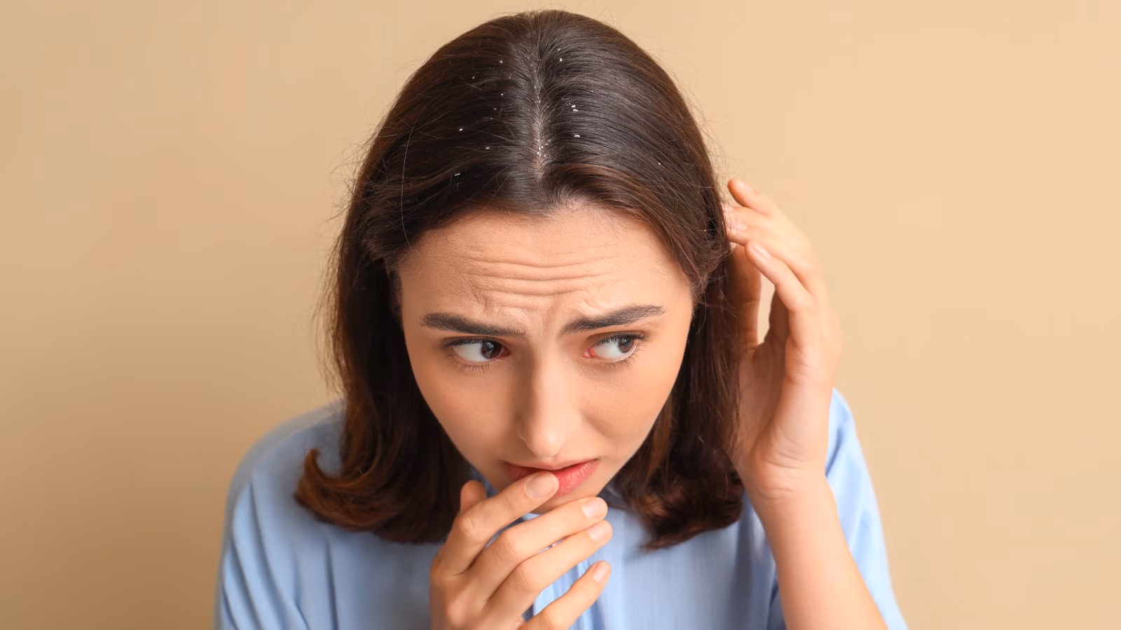 Say goodbye to dandruff naturally with this ancient spice